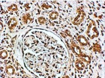 Goat anti-VPS41 Antibody