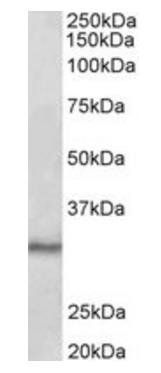 Goat anti-CTDSP1 Antibody