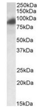 RAB11FIP1 antibody