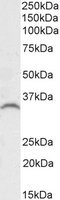 GDF15 antibody