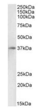 ACKR1 antibody (Biotin)