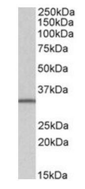 SLC9A3R2 antibody