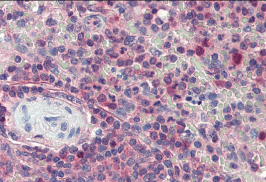 Goat anti-Karyopherin (importin) beta 1 Antibody