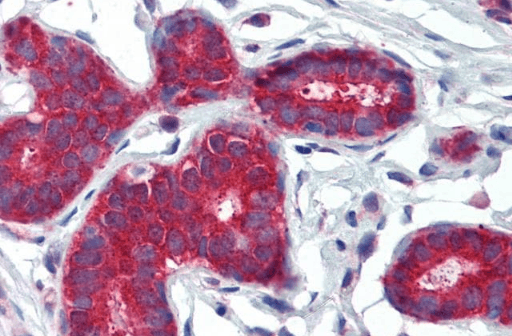 Goat anti-PTCH (C Terminus) Antibody