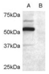Goat anti-DCDC2 Antibody