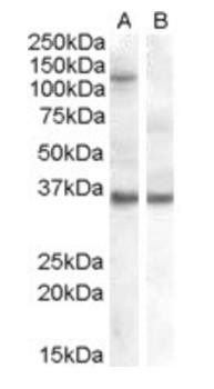 Goat anti-EIF2C1 / AGO1 Antibody
