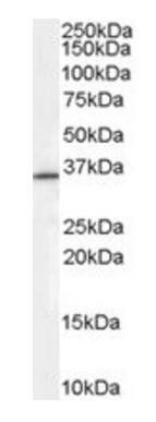 Goat anti-Rabring 7 / BCA2 Antibody