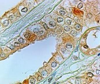 Prostaglandin E Receptor EP1 antibody