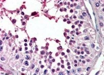 Goat anti-PIAS2 Antibody