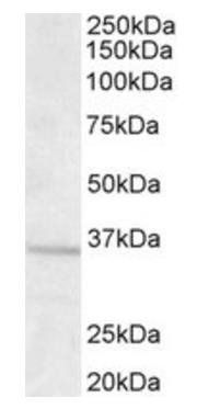 Goat anti-GNB3 Antibody