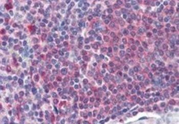 Goat anti-Catalase / CAT Antibody