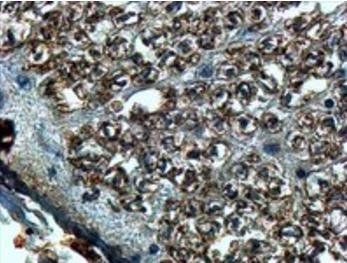 Goat anti-SLIT2 Antibody
