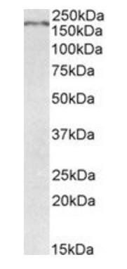 Robo1 antibody