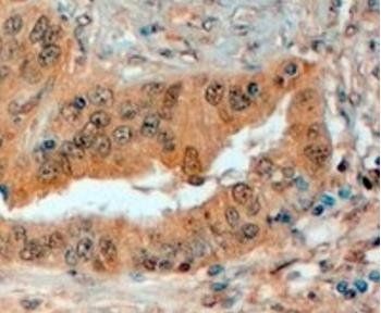 Goat anti-Semaphorin 3E (internal) Antibody