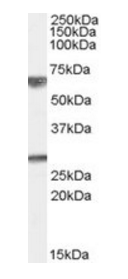 GPSM2 antibody