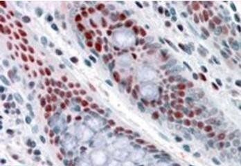 Goat anti-NAT10 / hALP Antibody