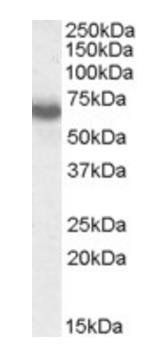 Goat anti-IKZF1 / IKAROS Antibody