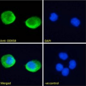 Goat anti-DDX58 Antibody