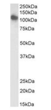 Goat anti-KCC3 / SLC12A6, Biotinylated Antibody