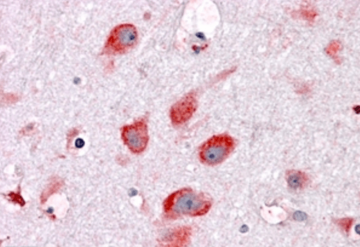 Goat anti-Ribosomal protein L22 Antibody
