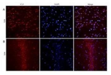 BDNF antibody