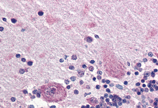 Goat anti-PPP2R3A Antibody