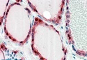 Goat anti-Frizzled 2 Antibody