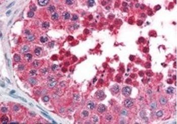 Goat anti-HSPA4L Antibody