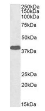 EPM2A antibody (Biotin)