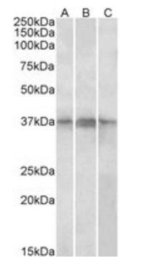 Goat anti-PHF11 Antibody