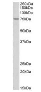 Goat anti-TDP1 Antibody