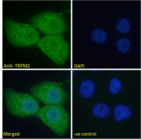 Goat anti-TRPM2 Antibody