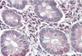 Goat anti-SLC10A2 / ASBT Antibody