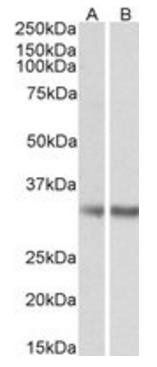 Goat anti-Monoglyceride Lipase Antibody