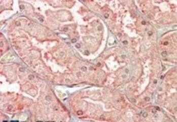 Goat anti-SFRP1 Antibody