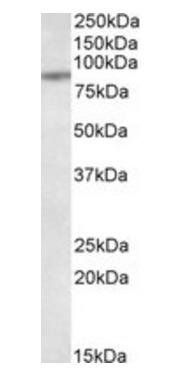 Goat anti-TAP1 Antibody
