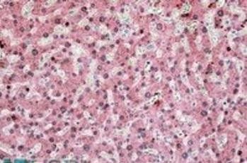 Goat anti-ITIH4 Antibody