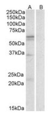 Goat anti-LAT1 / SLC7A5 Antibody