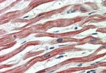 Goat anti-EPM2AIP1 Antibody