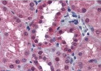 Goat anti-P2RX7 / P2X7 receptor Antibody