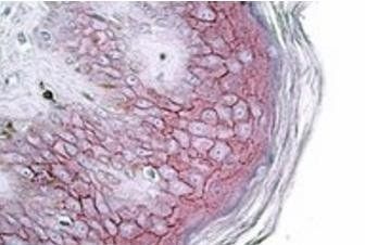 Goat anti-Desmoglein 1 / DSG1 Antibody
