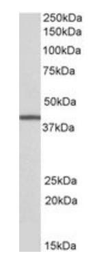 Goat anti-TRIB1 / SKIP1 Antibody