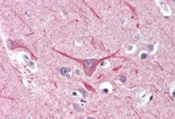 Goat anti-UBR2 Antibody