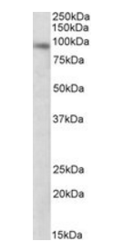 DTX3 antibody