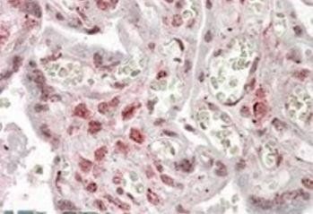 Goat anti-MLX Antibody