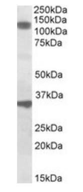Goat anti-CCAR1 Antibody
