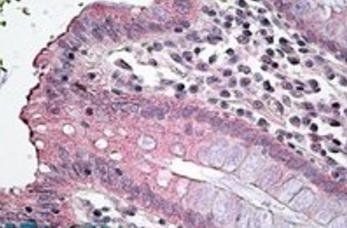 Goat anti-SLC12A2 Antibody