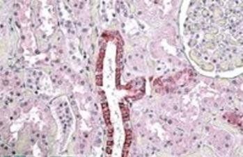 Goat anti-TGFBI Antibody