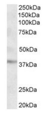 Goat anti-MICS1 / GHITM (aa117-127) Antibody