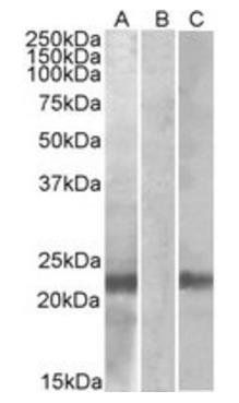 Goat anti-Cystatin 8 (aa 100-112) Antibody